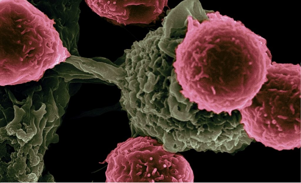 Virus para matar a las células cancerígenas