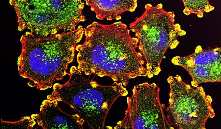 Científicos modifican un virus para matar células cancerígenas y obtienen resultados muy prometedores