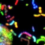 IA puede marcar cáncer de colon de manera más precisa que los médicos