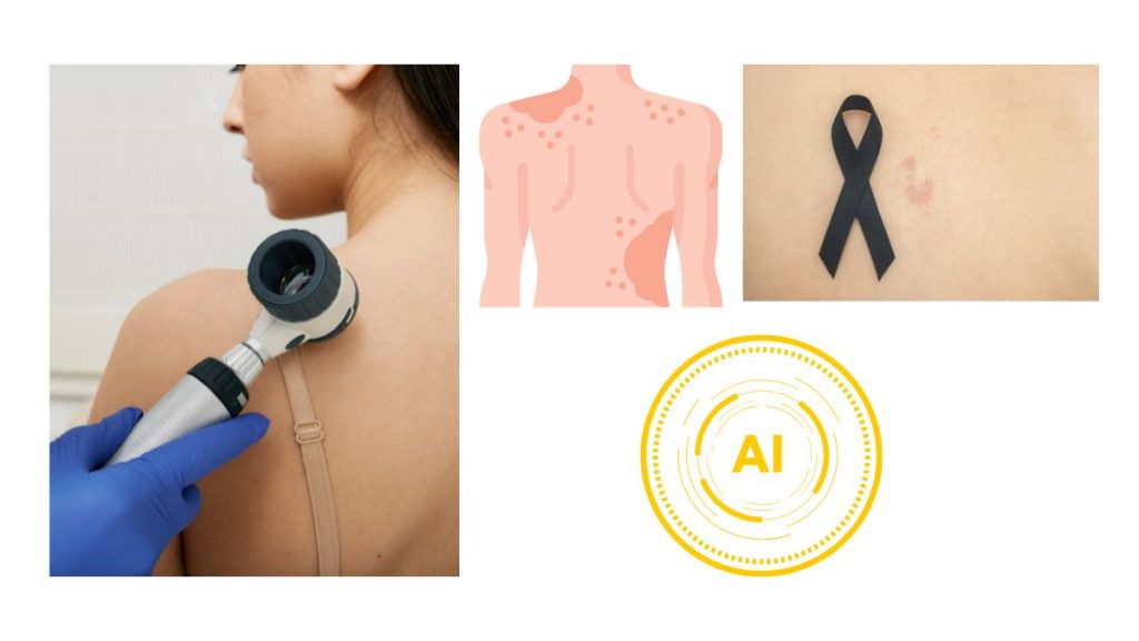 prevención del cancer de piel con IA - salud - bienestar